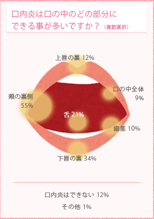 口内炎を写真で解説診察室でよくみる大人の病気 - みやけ内科・循環器科
