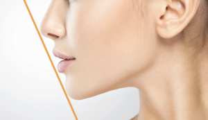フェイスラインを綺麗にする方法と横顔改善
