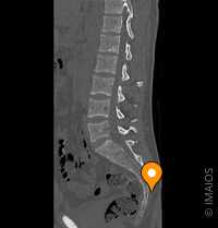 twitter用仙骨裂孔ブロックキャッチ - 貴晶会戸田リウマチ科クリニック