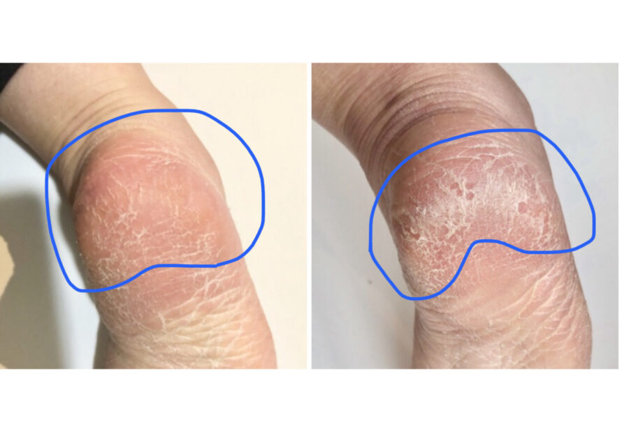 La SACHI 爪やすり & かかと角質取り セルフケア セット ガラス製 爪磨き かかと削り フットケア ネイルケア つめ ヤスリ 軽石つめやすり つめみがき つめとぎ 爪ヤスリ 爪みがき 爪とぎ ハンドケア シンプル ネイル用品 マニキュア ペディキュア セルフネイル