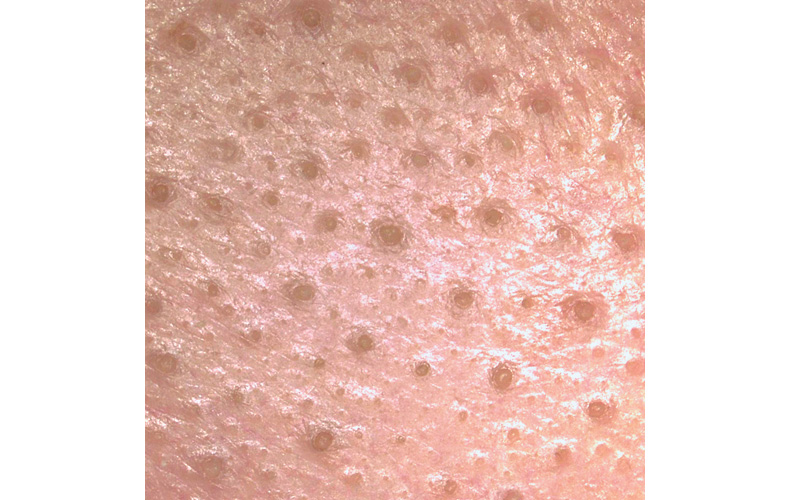 毛穴の白いニョロニョロの正体とは？原因や簡単なケア方法を紹介ハダメディア by BIHADADO.TOKYO