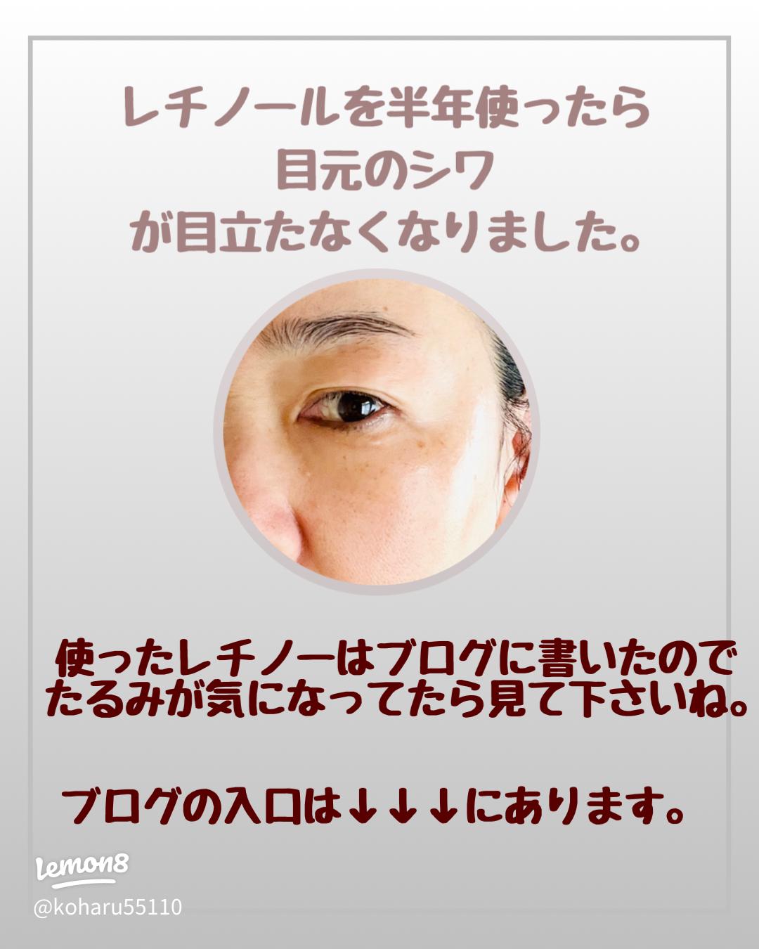 ほうれい線にニベア青缶は効くの？シワにもいいの！？ - やばい！ほうれい線をとる方法