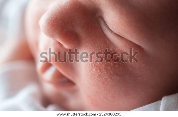 鼻 小さなプツプツ毛穴？？ - お見苦しい画像で申し訳ござい Q&A - @cosme アットコスメ