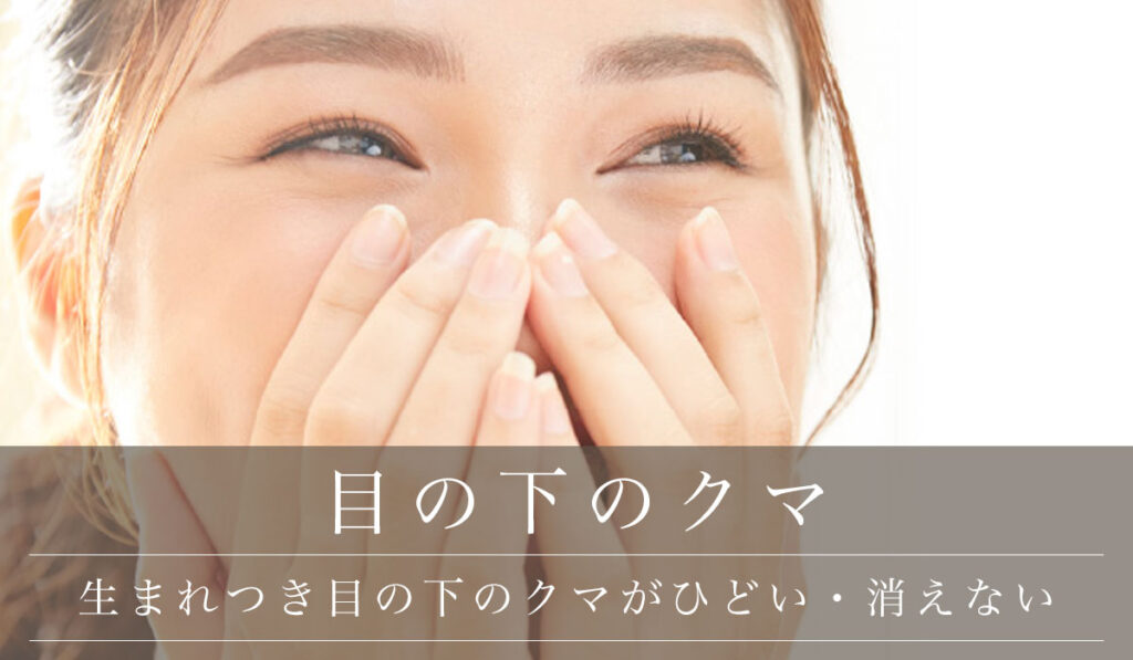 子供の生まれつきの目の下のクマは消えない？セオリークリニック- 東京・銀座の美容外科