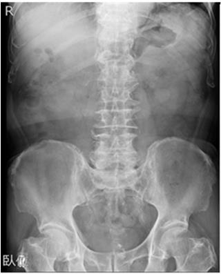 股関節の痛み 武田 健太郎 治療や手術について、患者さんとくわしくお話して不安を取り除いてあげたいと思っています