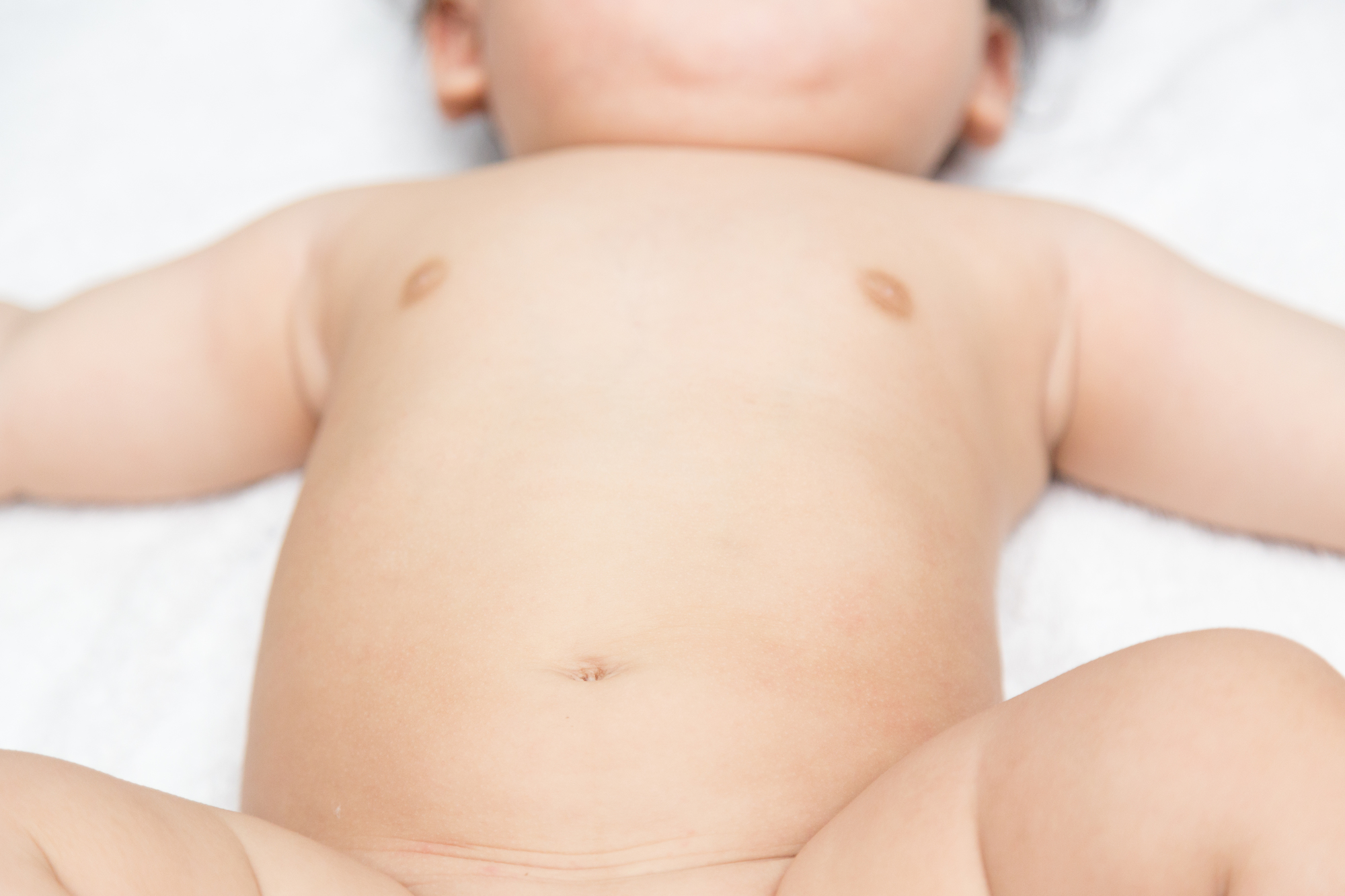 臍炎・臍肉芽腫 症例写真 の説明スライド - 医療のイラスト・写真・動画、素材販売サイトのメディック medick