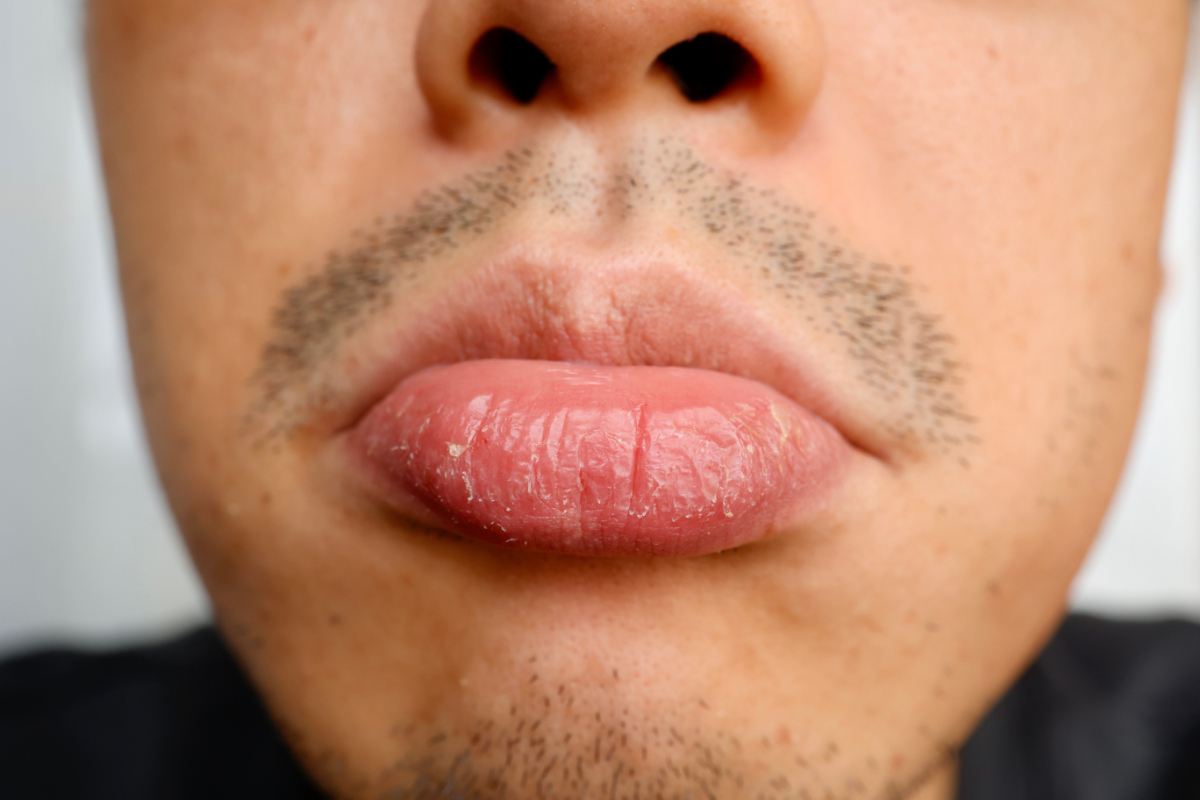 リップクリームで唇が荒れる！？Dr.TAKAKOの“花嫁美肌”の作り方