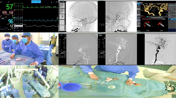 お知らせ埼玉医科大学国際医療センター脳神経外科
