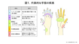 指の関節が痛いのはなぜ！？～原因や治療方法など公開中～ - ゆらら鍼灸整骨院 - 東大阪 - 八尾 - 大東
