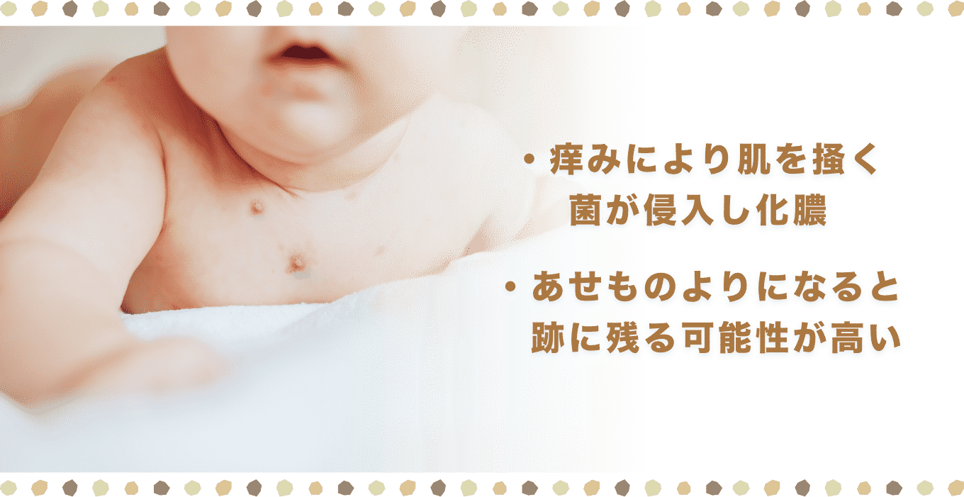 汗も野田市 小児科 千葉県 こどもの花粉症 こどもの漢方 喘息 アトピー性皮膚炎 アレルギー 結節性痒疹 たんぽぽこどもクリニック