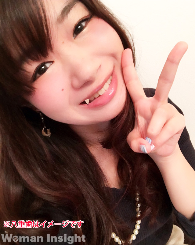 裏側矯正治療の魅力とは