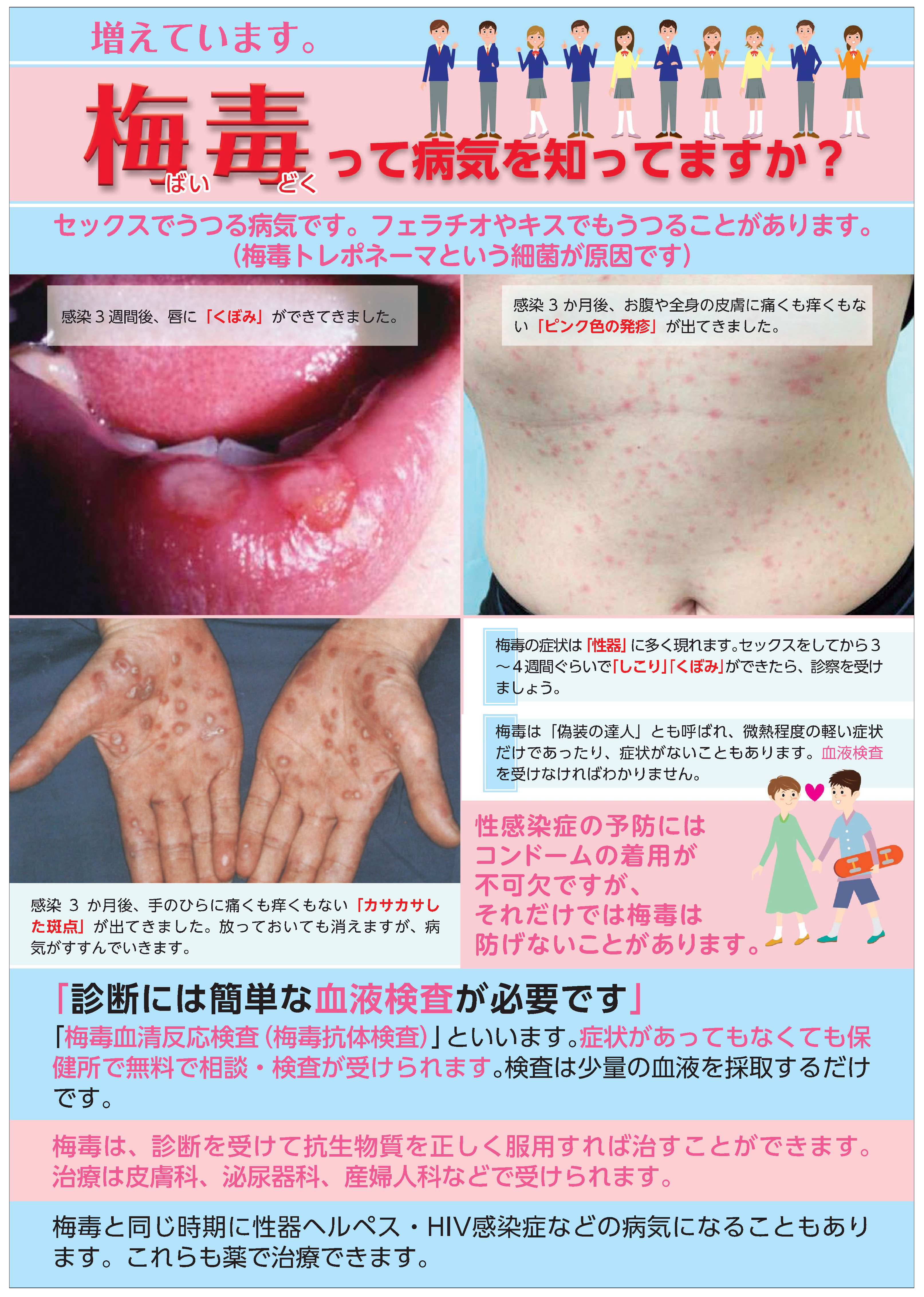 梅毒とは？初期～末期症状・感染経路について検査と治療方法を解説 - GOETHE メンズクリニック