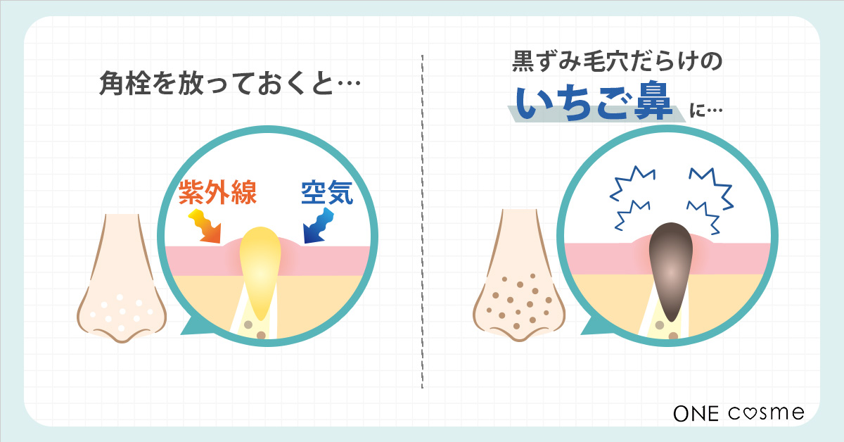 鼻の横に出てくる白いカスのようなもの、どうするのが正解？ - Q&A - @cosme アットコスメ