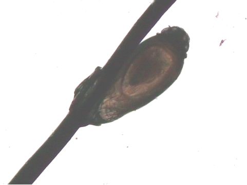 毛細血管拡張の改善には！しらゆりメディカルエステ