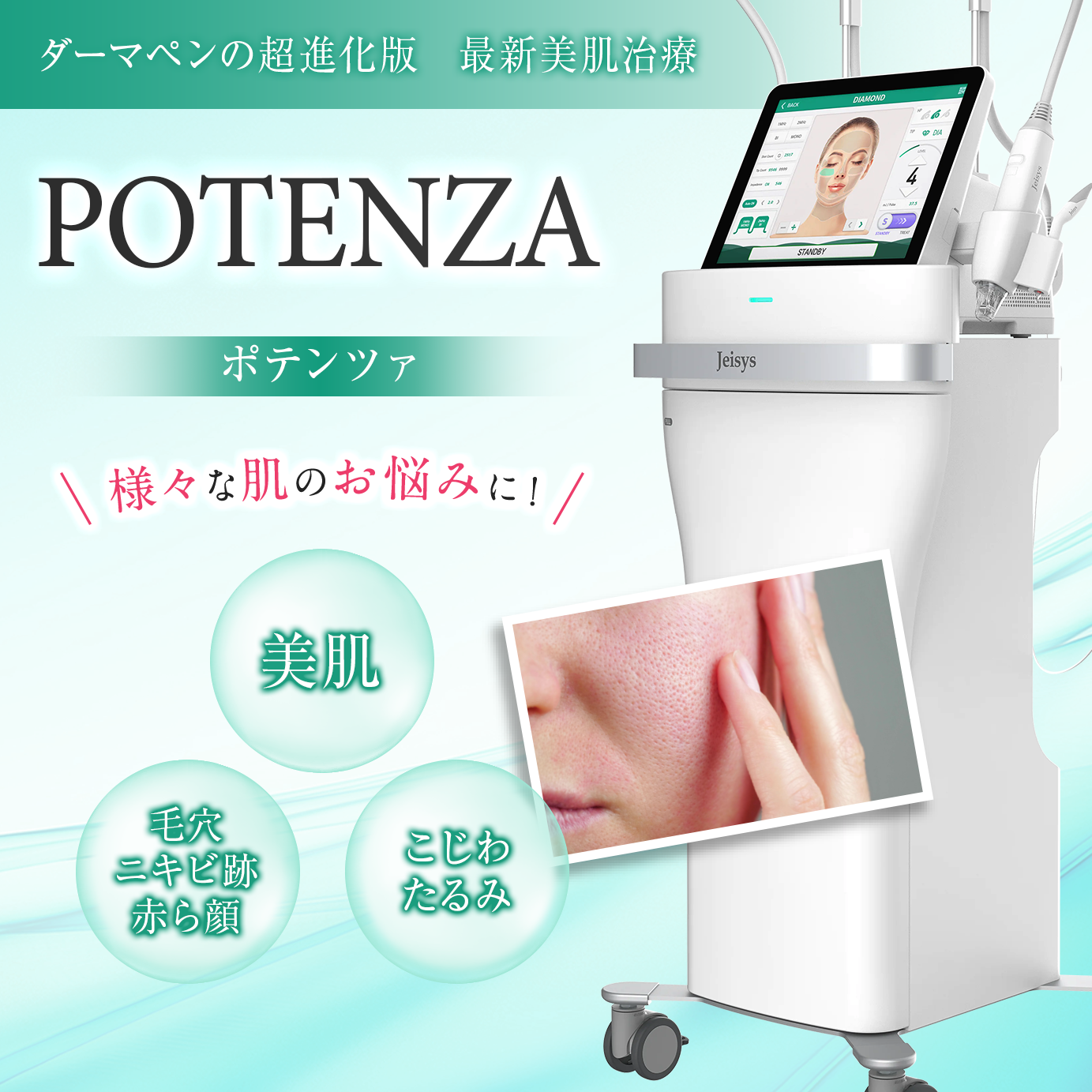 体験談 ポテンツァSチップで開き毛穴ケア池袋サンシャイン通り皮膚科レポ美容とこどもと、わたしの記録