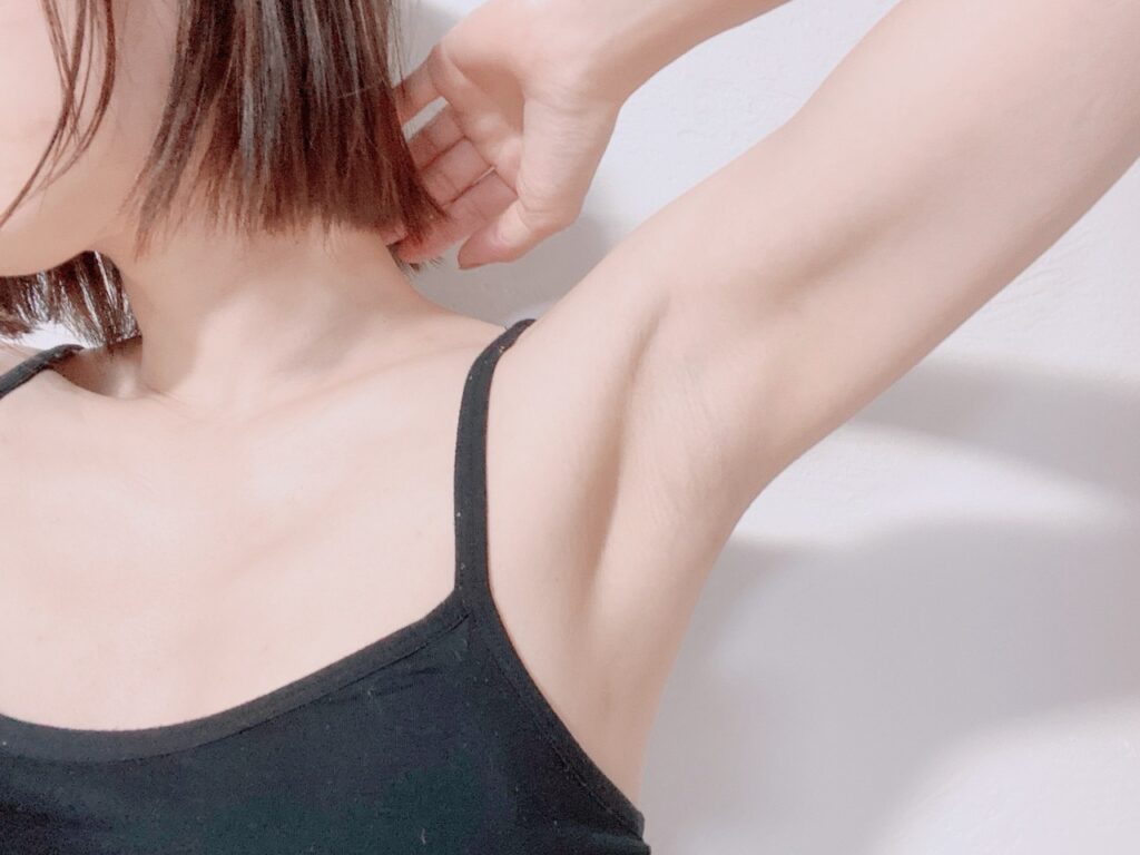 両脇脱毛☆ビフォーアフター写真有 - Virgin Wax