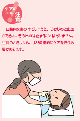 高齢者の口腔ケアをする介護士のイラスト素材FYI05054194ストックフォトの Qlean Market キュリンマーケット