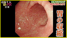 お腹の音が気になってしまう！お腹がギュルギュル、ゴロゴロ鳴る理由と対策は？えぞえ消化器内視鏡クリニック