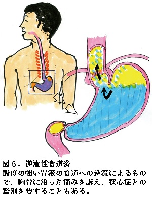 胸骨の剣状突起が痛いYURUKU®︎考案者ノリコ＊背骨のねじれを生む日常動作のクセを紐解く姿勢と歩き方改善トレーニング