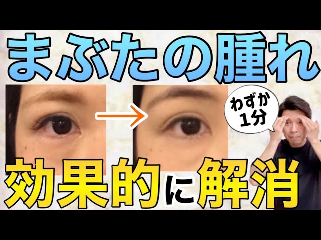 瞼が腫れぼったい眼瞼下垂を全切開せずに治療 脱脂＆当院式埋没術・新挙筋法美容整形の他院修正治療なら美容外科Kunoクリニック
