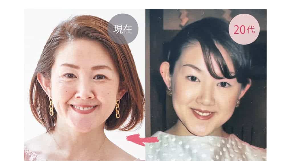 🟢頭蓋骨の老化による鼻の変化🟢Raplit