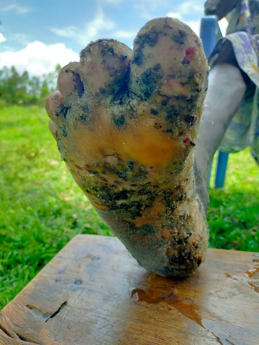 あきの公造 参議院議員3期福岡県選挙区على X: