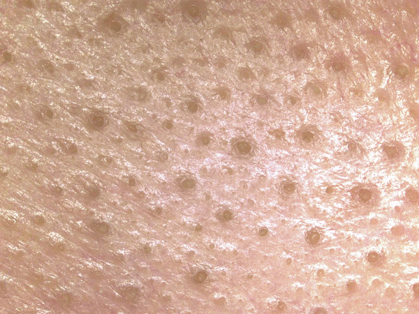 毛穴ケア巨大角栓 角栓 角栓除去 角栓ケア 角栓すっぽり 角栓抜き 角栓吸引 角栓 毛穴 毛穴すっぽり 毛穴空っぽ 毛穴エクストラクション 毛穴の黒ずみ エクストラクション 毛穴改善 毛穴自分でケア 自宅で毛穴ケア 鼻つるぴか ドバっと水