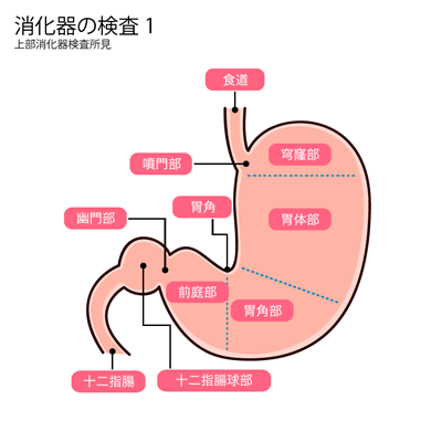 胃透視 バリウム 検査のご案内クアハウス石和