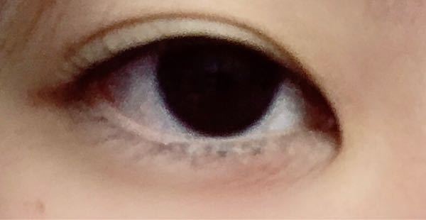 蒙古襞が張っていて切開ラインが綺麗に描けないのですがコツなどありますか？- Yahoo!知恵袋