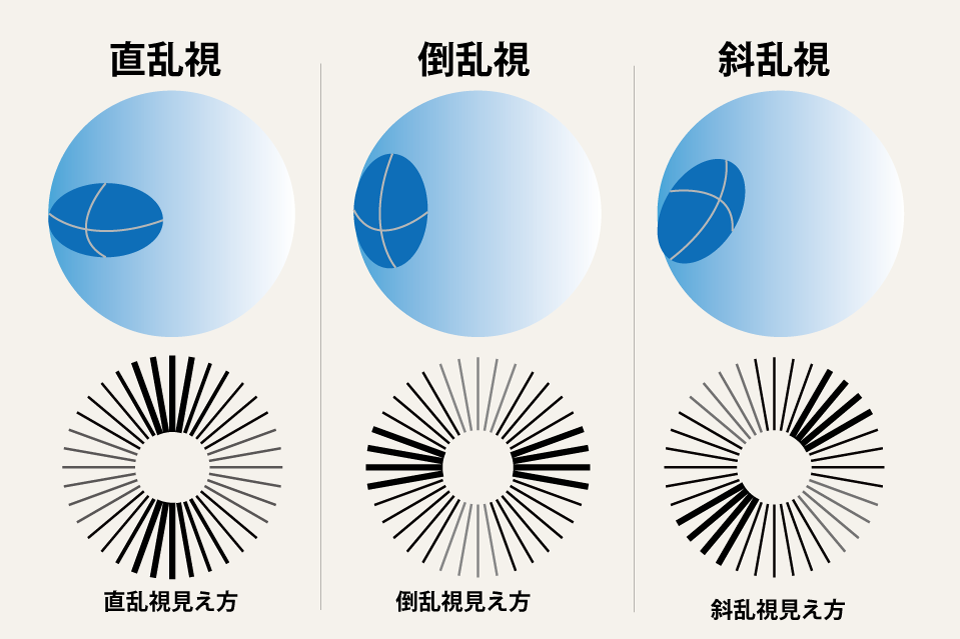 正視近視・遠視・乱視・弱視の視力回復 東京視力回復センタ