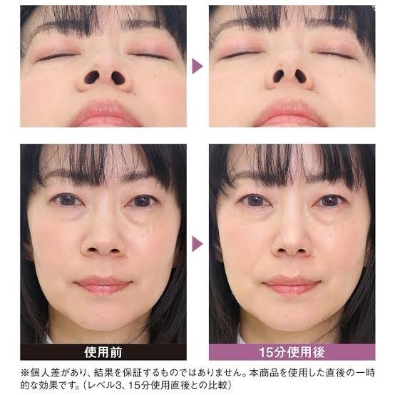 LUXCEAR Fornez ルクセア フォーネス 鼻 美顔器 EMS 忘れ鼻 ノーズクリップ 高く 鼻クリップ RSL発送 rlt 60s :りかの良品 Yahoo!店 - 通販 - Yahoo!ショッピング