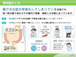 イレウスイラスト無料イラスト・フリー素材なら「イラストAC」