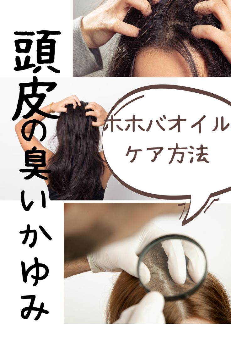 ハゲ対策 頭皮の悩みに！ホホバオイルを使った頭皮ケアを紹介します！ 薄毛、白髪、頭皮の臭い