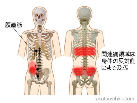 プロが解説 筋肉痛でも腹筋はしてもOK！痛みを和らげる5つの方法と予防策もRETIO BODY DESIGN