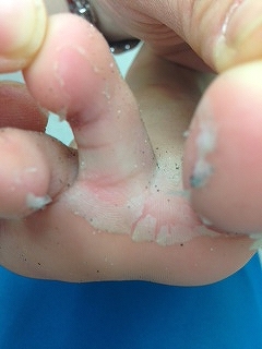 かわいい赤ちゃんの足に赤い口紅の接吻の写真素材・画像素材 Image 25970789