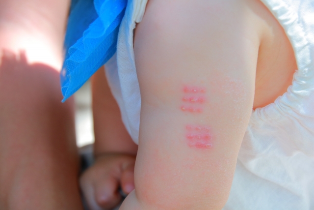 インフルエンザワクチンの副反応について 症状や日数は？子どもが発熱したらどうする？キッズドクターマガジン