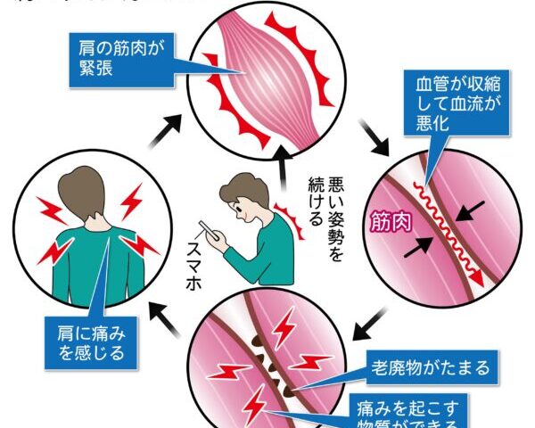 整体 - げんきや接骨院本町は土・祝も営業。腰痛・肩こり・骨盤矯正・交通事故治療はお任せください