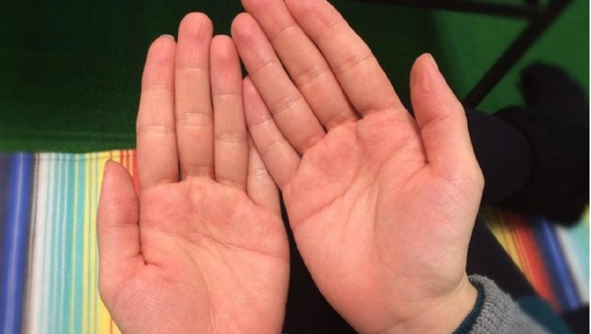 あれば超ラッキー。「珍しい手相」ランキングニコニコニュース