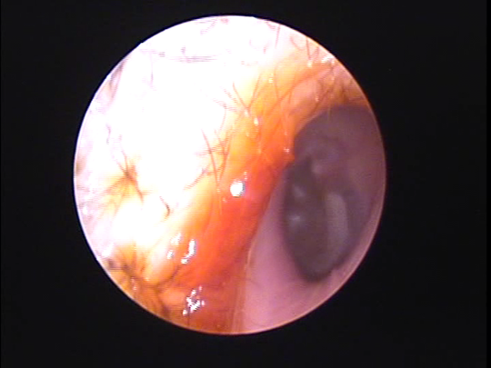 耳の痒み - クリニックブログ - いのうえ耳鼻咽喉科岩倉市の耳鼻咽喉科・小児耳鼻咽喉科・アレルギー科