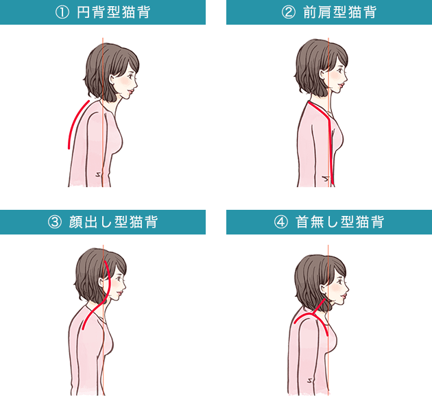 ストレートネック解消のために - ＫＣＳセンター たかの施術院
