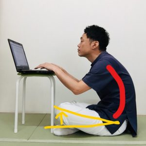 坐骨神経痛 座り方痛みに効く正しい姿勢とやってはいけないNG習慣