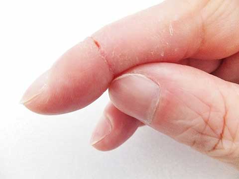 美容師・ハサミの持ち方による障害KIZUカイロプラクティック整体本院