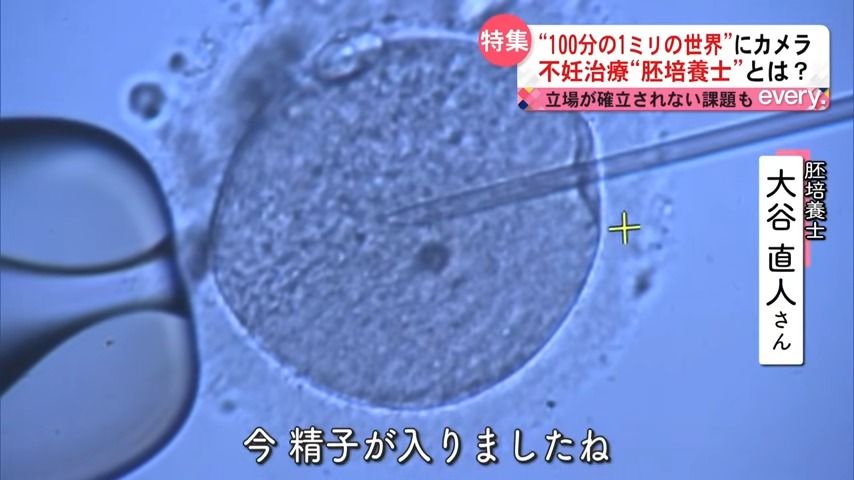 体外受精 - Wikipedia