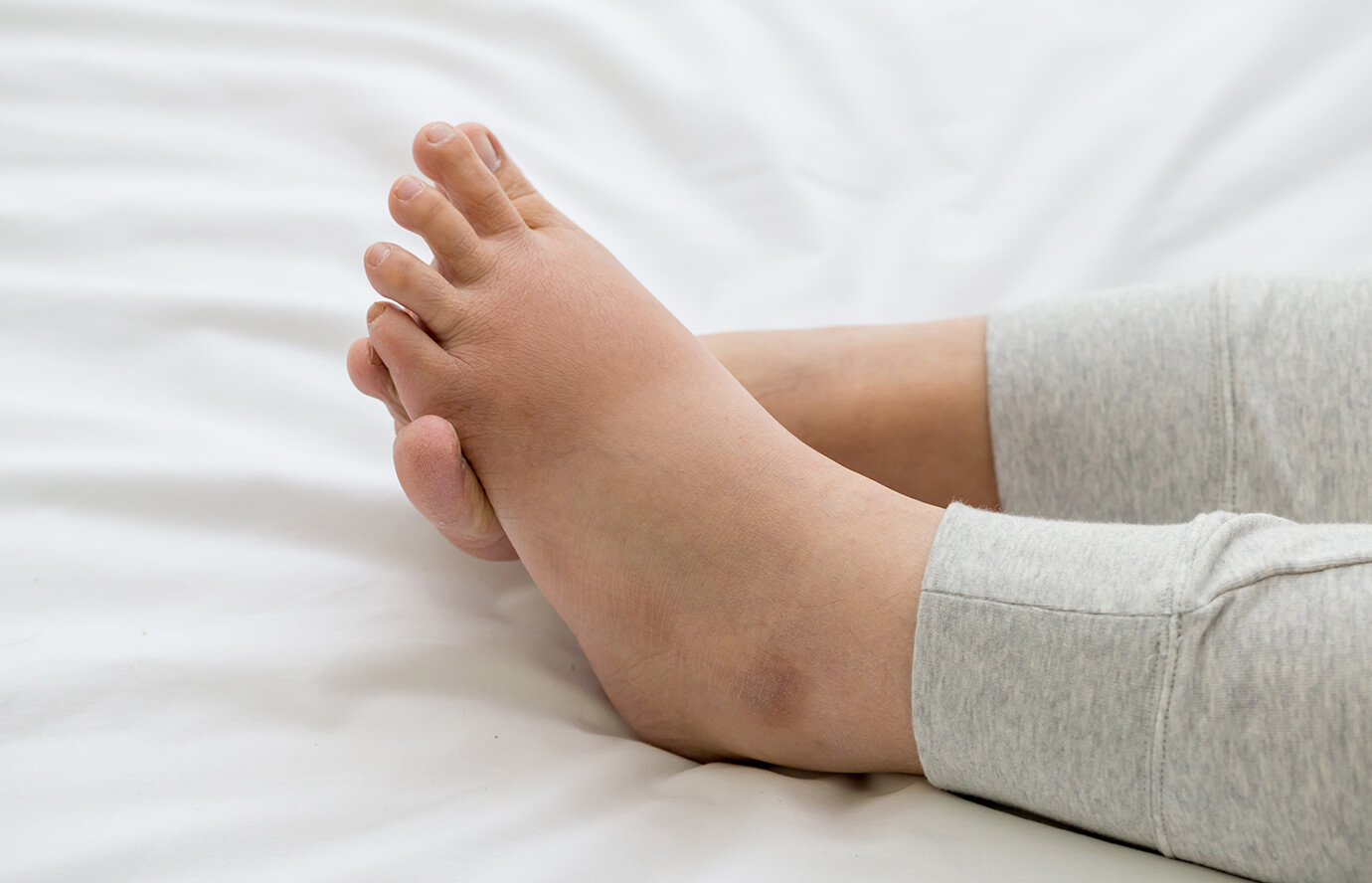 足のむくみがあるとき動く妊婦体操ほほえみクラブ 育児応援サイト