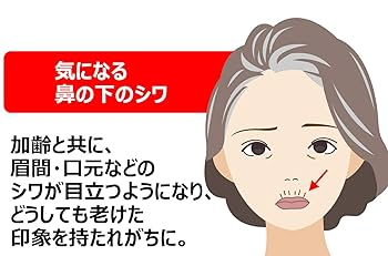 ヒアルロン酸注入 鼻唇溝 ほうれい線のしわ改善 30代女性 症例No.29T0000773樹のひかり形成外科・皮ふ科 奈良 美容整形・美容皮膚科クリニック
