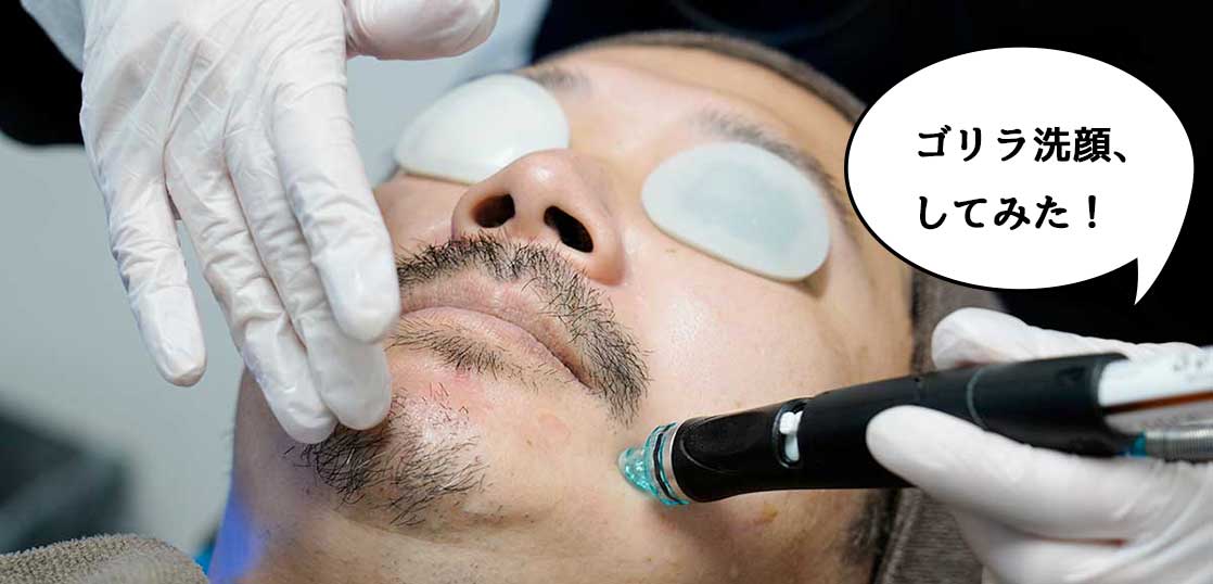 写真あり体験談 ゴリラクリニックでハイドラブースターを受けた結果おじケア