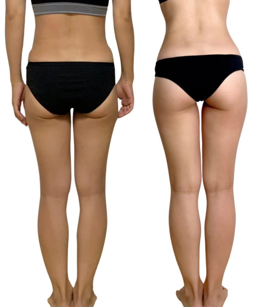 女性の体脂肪率30パーセントの見た目は太り過ぎ？写真付きで解説