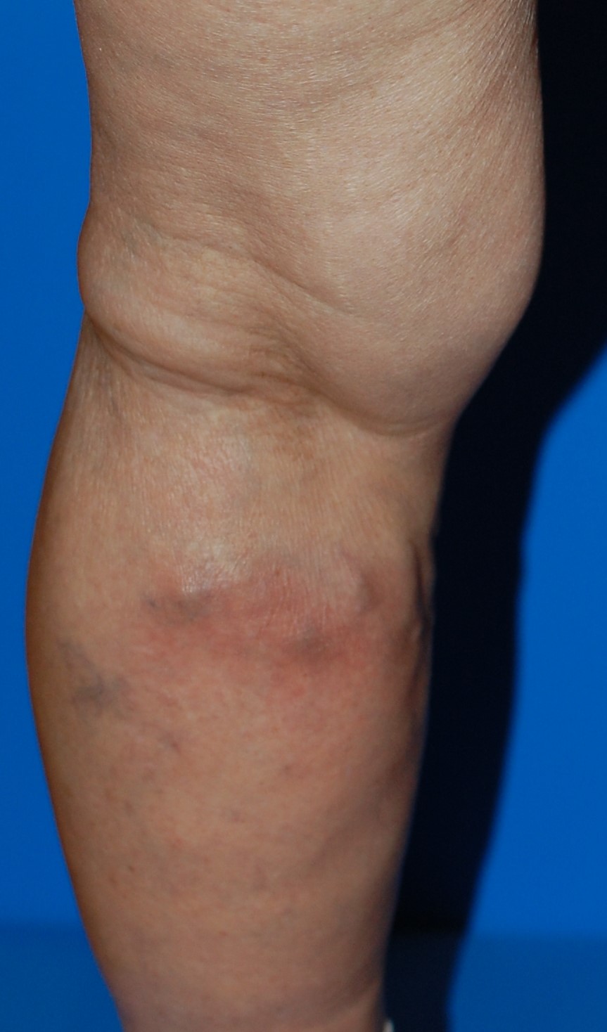 足がむずむずして眠れないのは、なぜ？ヘルスケアFANCL CLIP ・美容と健康の旬な情報をお届け♪