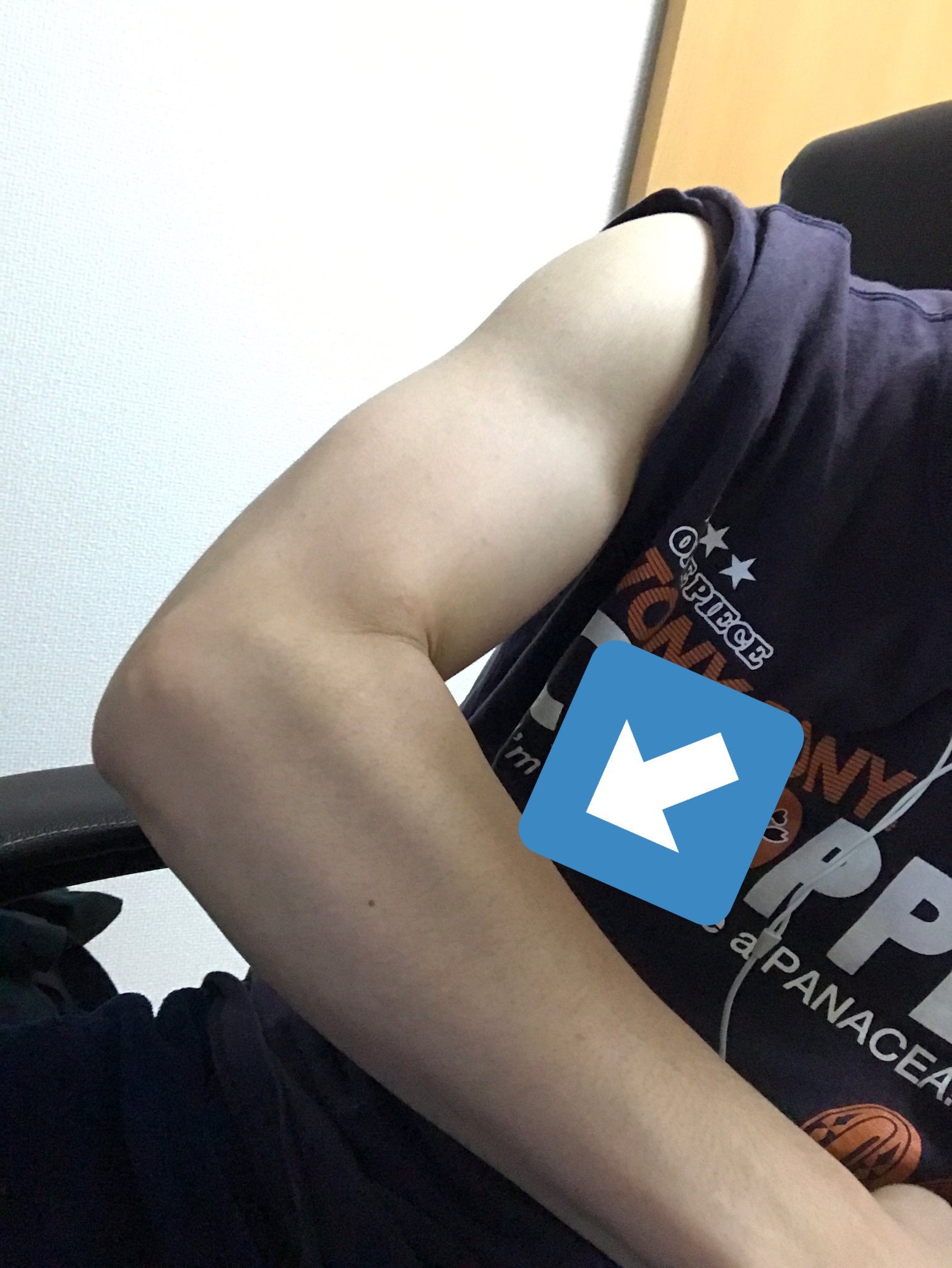 腕橈骨筋を正しく図で理解しよう。理学療法士・作業療法士・言語聴覚士の求人、セミナー情報なら POST