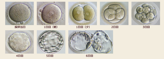 体外受精 IVF のプロセス体外受精について不妊治療・体外受精・人工授精医療法人オーク会